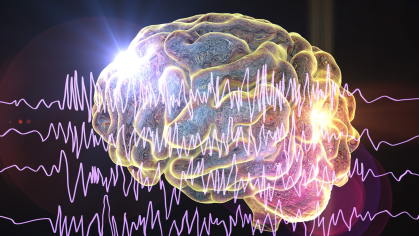 Electrical waves going through a brain